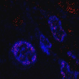 Elements de titane dans les cellules de l'intestin
