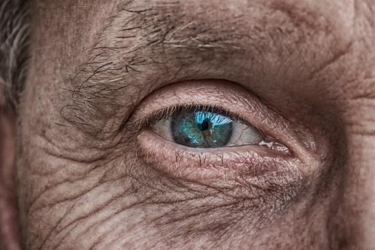 Vision loss due to AMD: discovery of a blood biomarker to assess the diet-related risk